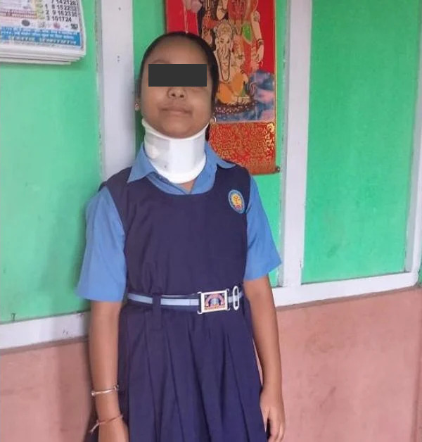 Muskan_Normal_Condition